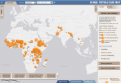 Global Fistula Care Map