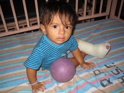 A young boy recovers from surgery. Photo courtesy of Operation Footprint. A young boy recovers from surgery. Photo courtesy of Operation Footprint.