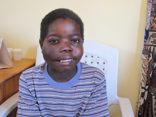 Jacinta after one course of cancer treatment.